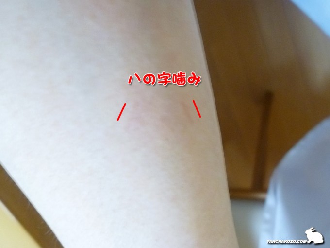 トフィのハの字噛み